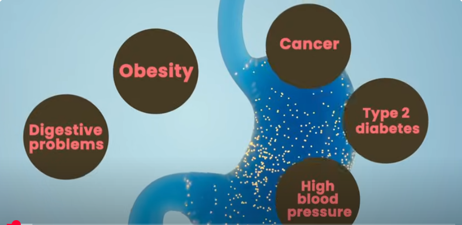 वजन घटाने के लिए इंटरमिटेंट फास्टिंग